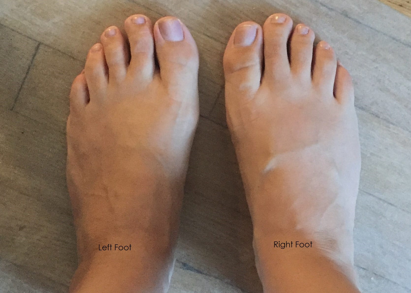 Example image of left and right feet.